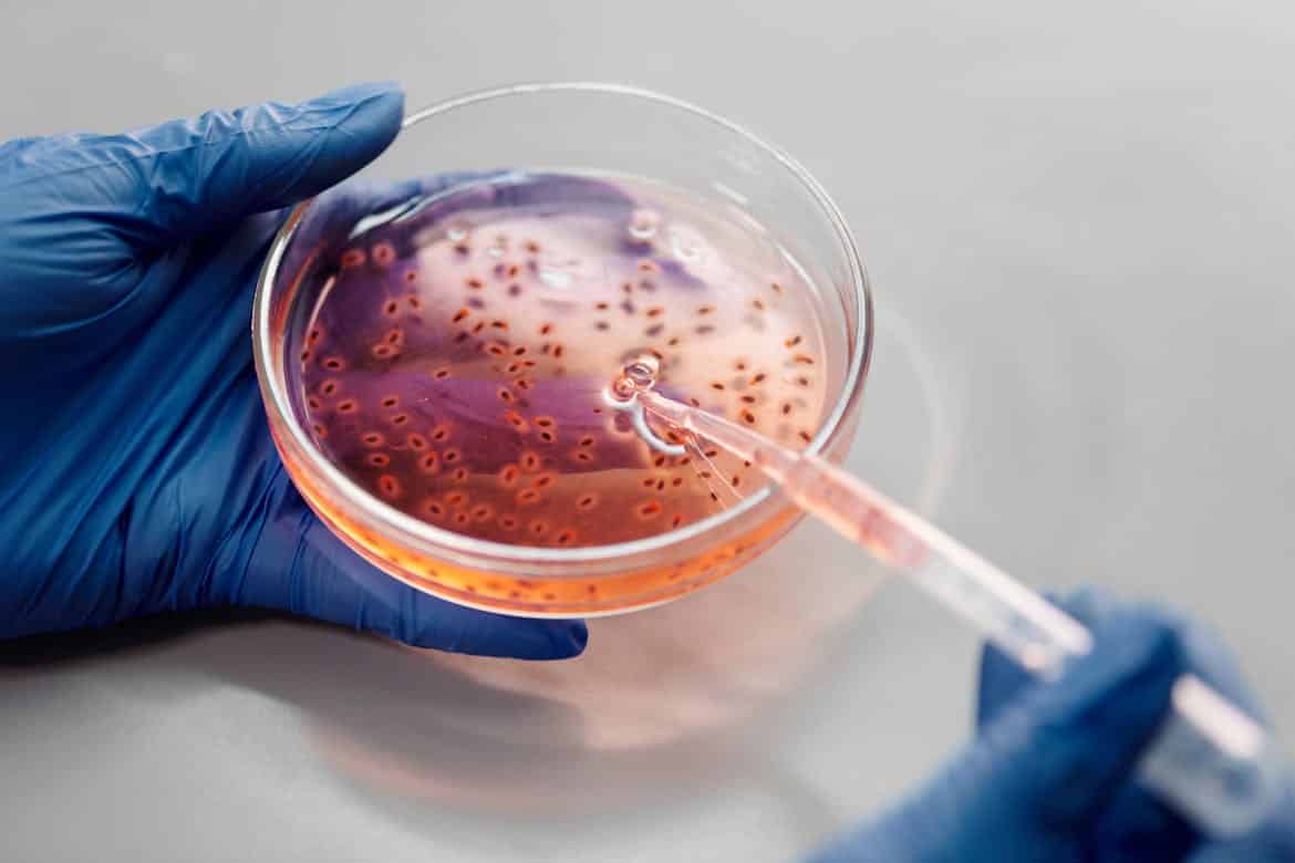 Superbug